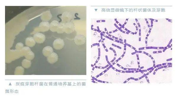 炭疽是由炭疽芽孢杆菌引起的人兽共患的急性传染病,主要流行于牛,马