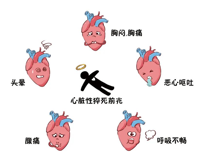 心脏性猝死有迹可循吗