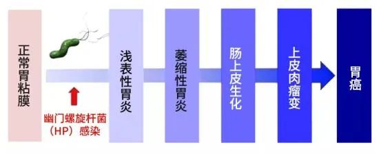 萎缩性胃炎有没有办法逆转阻断其进程