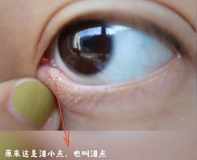 澎湃号>好奇博士> 它叫做"泪小点"在我们的眼角处有一个小孔之前给