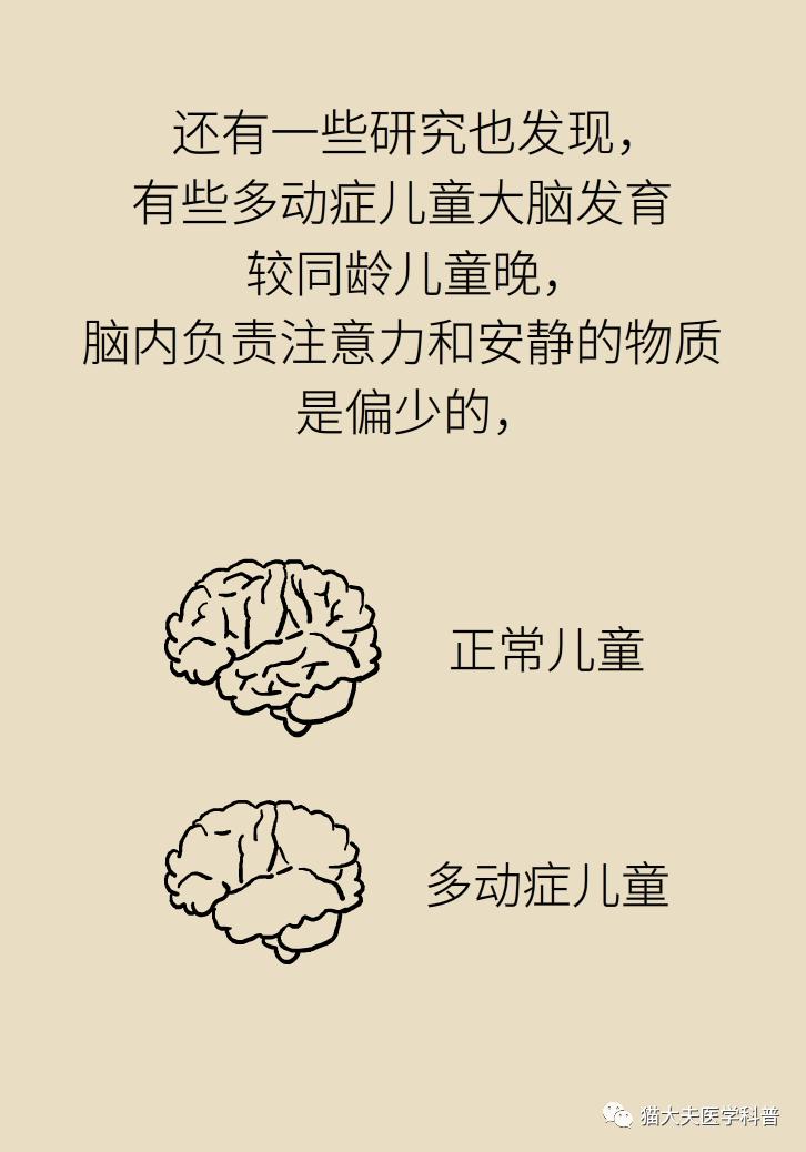 多动症是遗传的别再随便骂孩子了