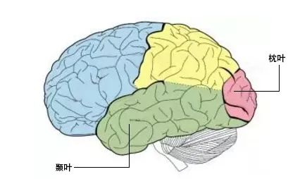 病因可能是大脑的颞叶皮层(位于耳朵正上方的颞部)和枕叶皮层(位于