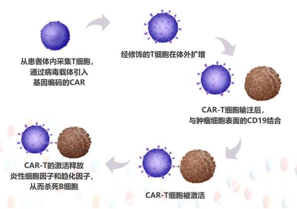 120万元一针癌细胞清零?详解car-t治疗