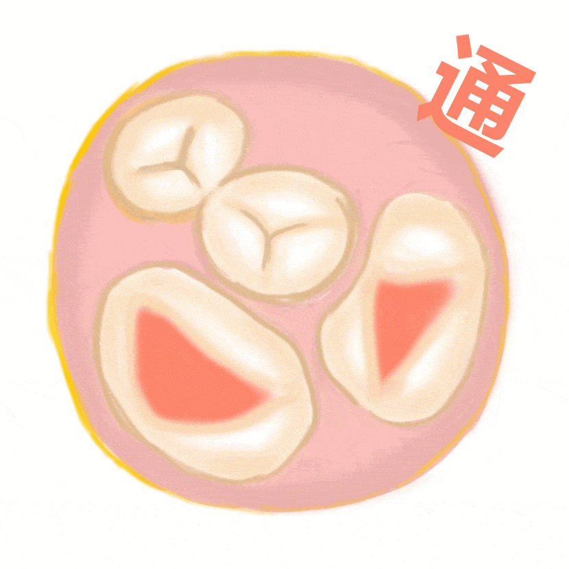 【世界心脏日】大咖讲科普(三):心脏得了风湿怎么办?