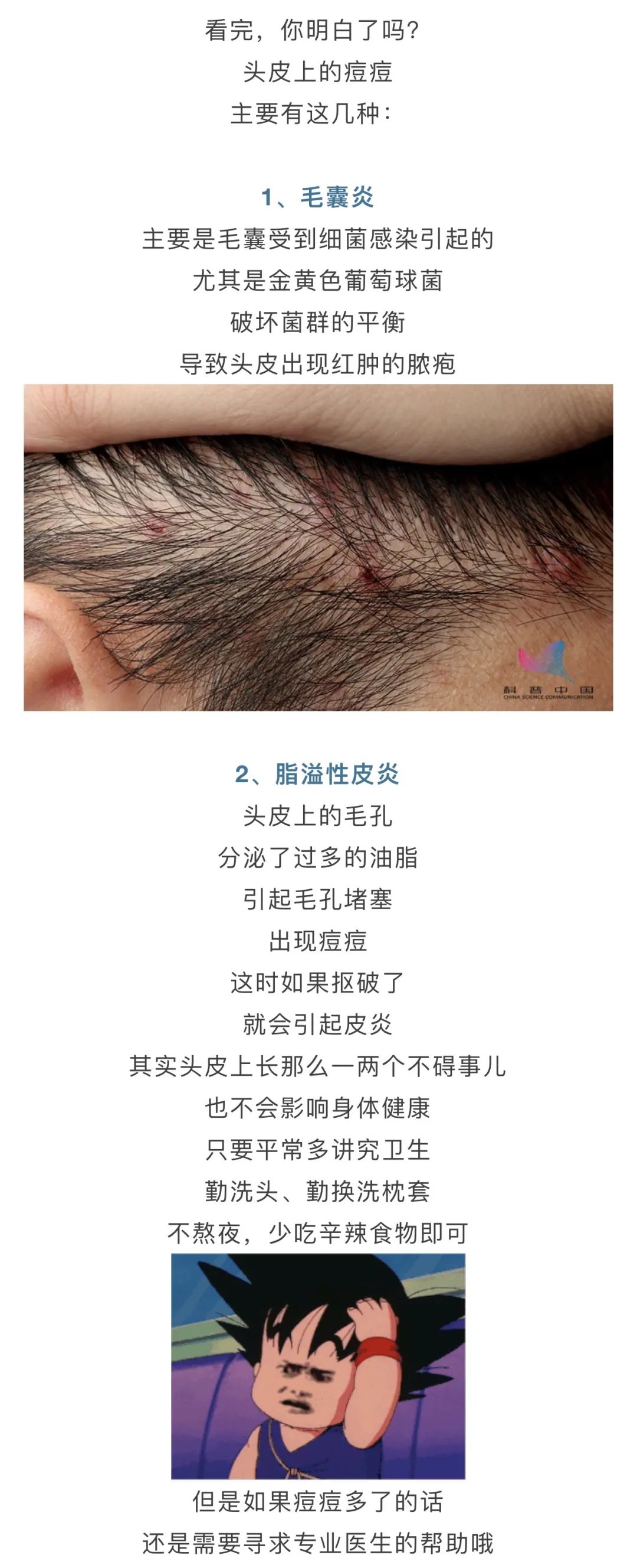 你有没有发现 痘痘不仅出现在脸上,后背上 头皮上竟然也会出现痘痘