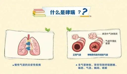 2,哮喘有哪些临床表现呢?