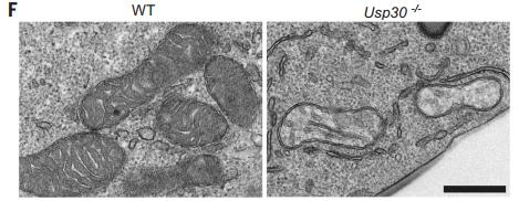 考虑到usp30在抑制线粒体自噬和调节ctls功能中的重要作用,该团队首先