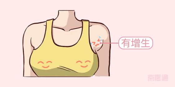 副乳毕竟是乳房,乳腺组织,脂肪,血管,淋巴都可能在其中,不可能单靠