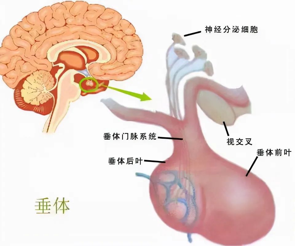 内分泌失调不孕,一查居然是垂体瘤,脑袋里的这个肿瘤你需要了解