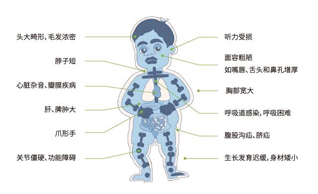 儿童医学中心内分泌科02 mpsii的诊断 由于黏多糖贮积的部位不同,可以