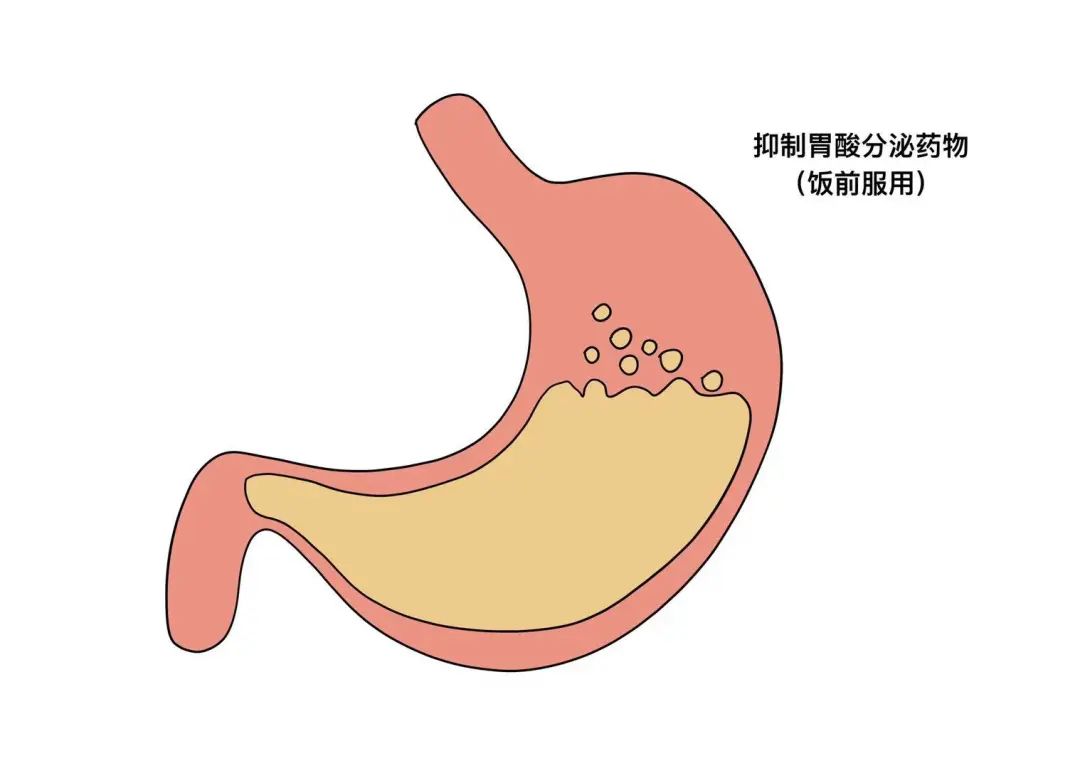 饭前还是饭后吃药,这个疑惑我来解答