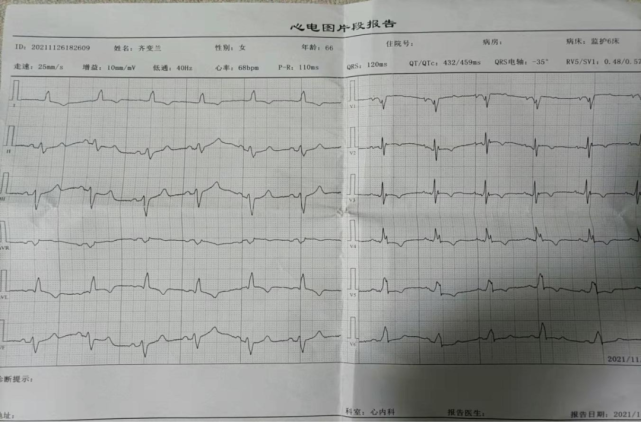 且获得了类似crt(三腔心脏起搏器)超反应的临床效果,随着该项技术的