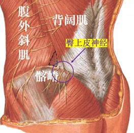 腰腿疼痛可能是臀上皮神经卡压在作怪如何缓解看这里