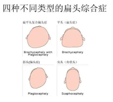 这2万8的矫正头型头盔哪个扁头星人看了不心动