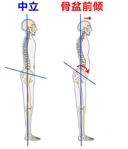 人不胖小肚子却突出当心骨盆前倾