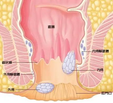 远离后股之忧