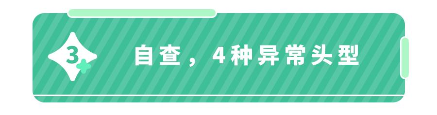 双手指向耳朵,从上至下观察是否在一水平线上,如果在就代表头型正常