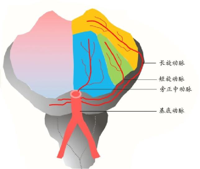 位于小脑上动脉和小脑前下动脉之间(见图1,主要包括脑桥旁正中动脉