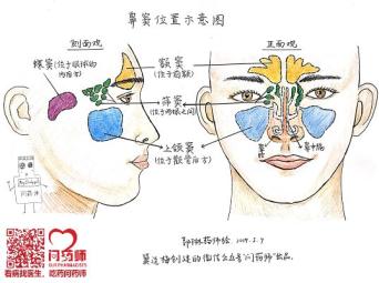 儿童鼻窦炎怎么治