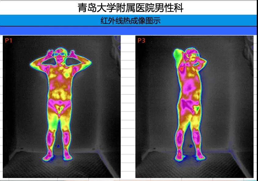 技术创新丨青大附院电生理诊疗技术精准诊治男性盆底障碍疾病