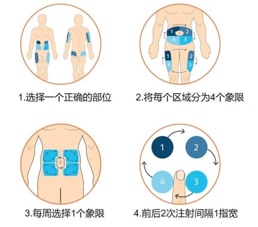 胰岛素注射常见的3个问题分别该如何解决