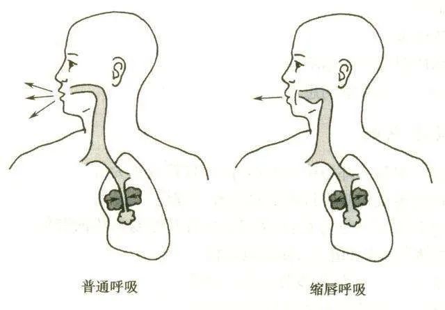 将舌尖放在下颌牙齿底部,舌体略弓起,靠近上颌硬腭,软腭交界,口唇缩成