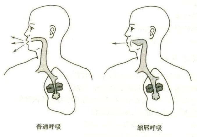 头条| 耳朵痛,眼镜起雾,呼吸不畅?戴口罩的4大困扰,看