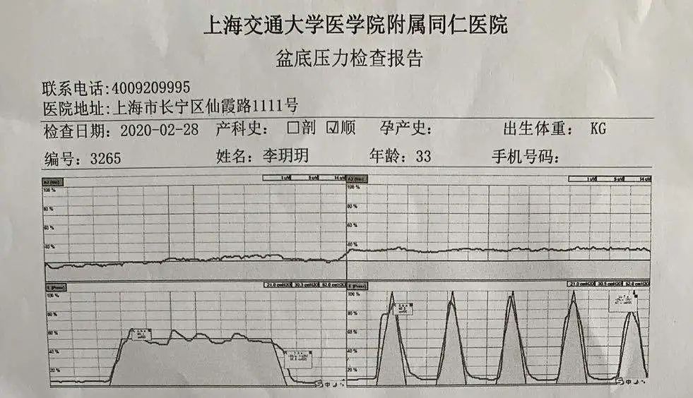 今天我终于迎来了产后42天的盆底肌测试,有种高考交付答卷的感觉.