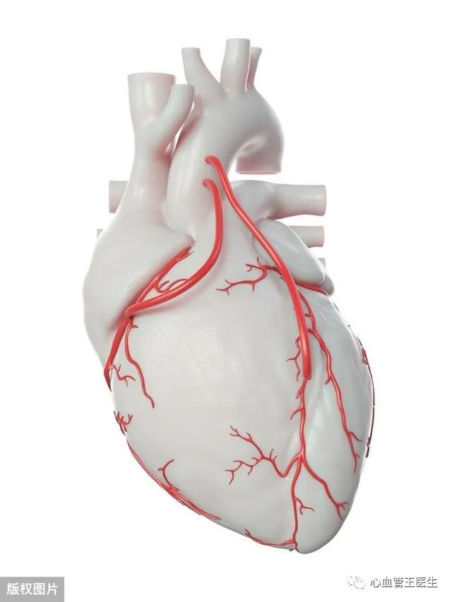 心脏3个血管严重狭窄,看医生如何解释心脏搭桥