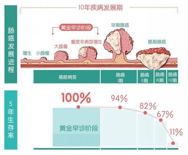 男子查出肠癌,原来大便早就有"提醒"