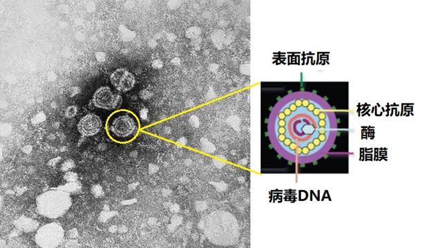 电子显微镜下的乙肝病毒.图源:据维基百科图修改
