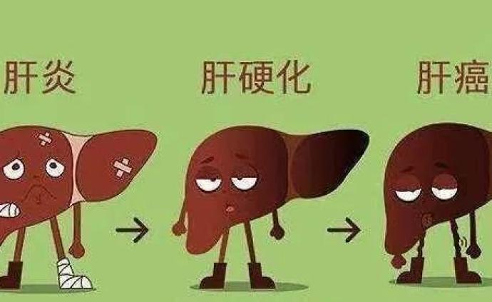 肝癌的危险因素,你中了几个?