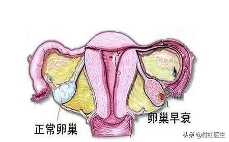 27岁的她50岁的卵巢,她做错了什么?