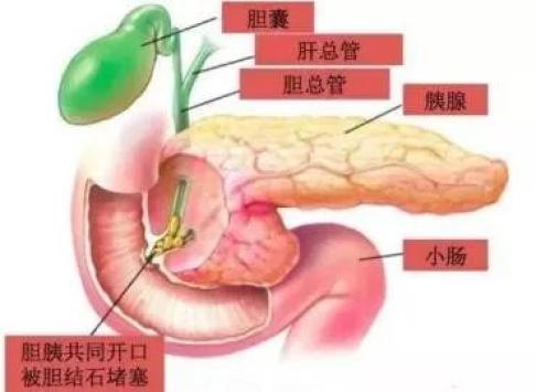 那个叫胰腺的器官"suicide"了