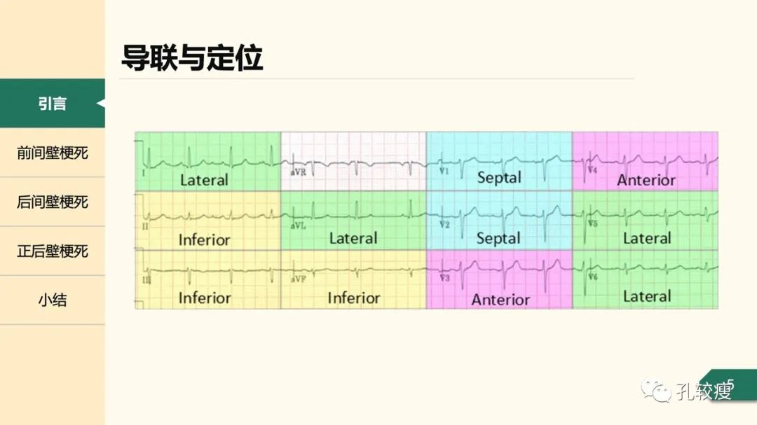 心肌梗死心电图定位的困惑及思考