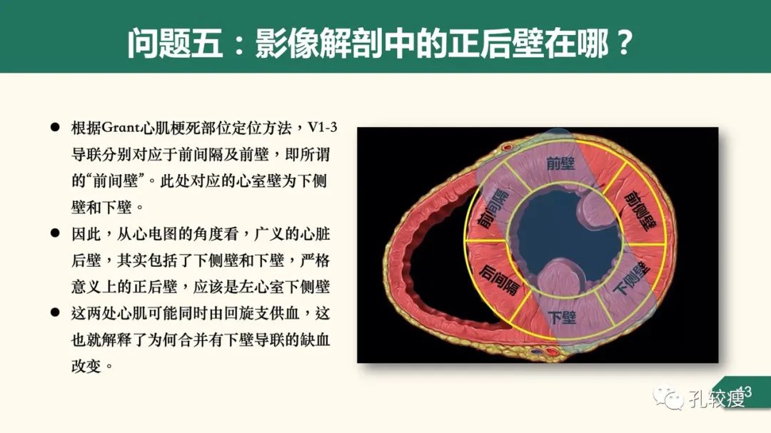 心肌梗死心电图定位的困惑及思考