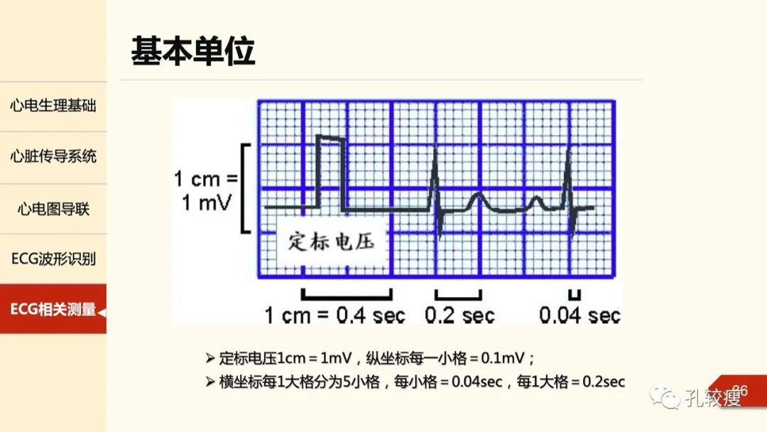 心电图诊断入门:导联基础及图形识别