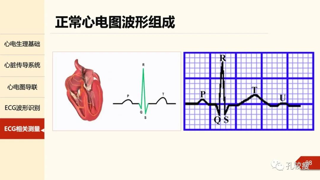 心电图诊断入门:导联基础及图形识别