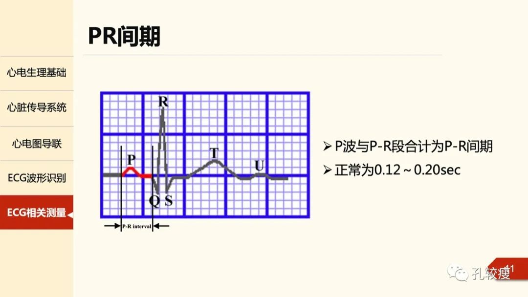 心电图诊断入门:导联基础及图形识别