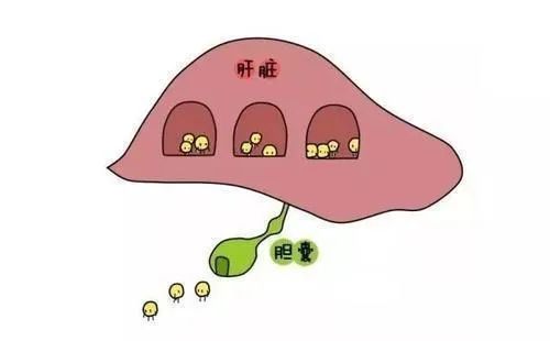 胆囊息肉有必要"一切了之"吗?听听松江医生怎么说