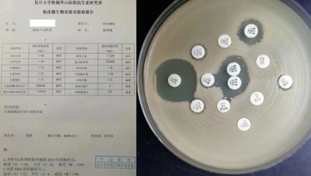 我们在体外用多种抗菌药物模拟了一场"联合战役,即联合药敏试验