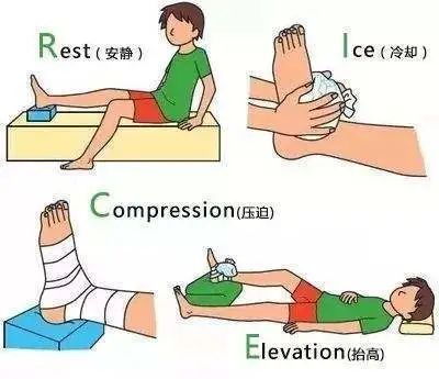 踝关节扭伤怎么办这样处理很重要