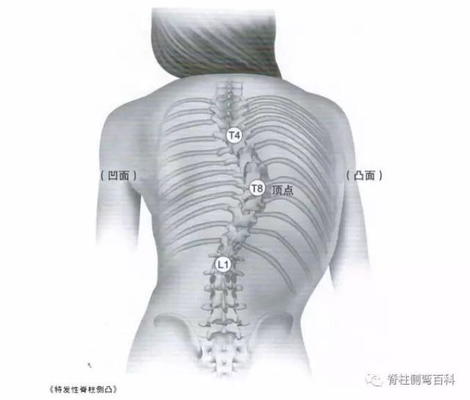 具体做法如下: 被检查者面向检查者站立,全身放松,裸露腰背部,双脚