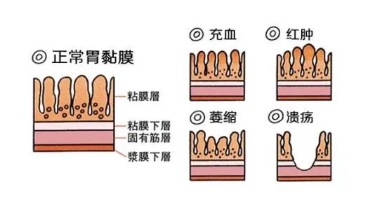 修复胃粘膜应多吃哪些食物