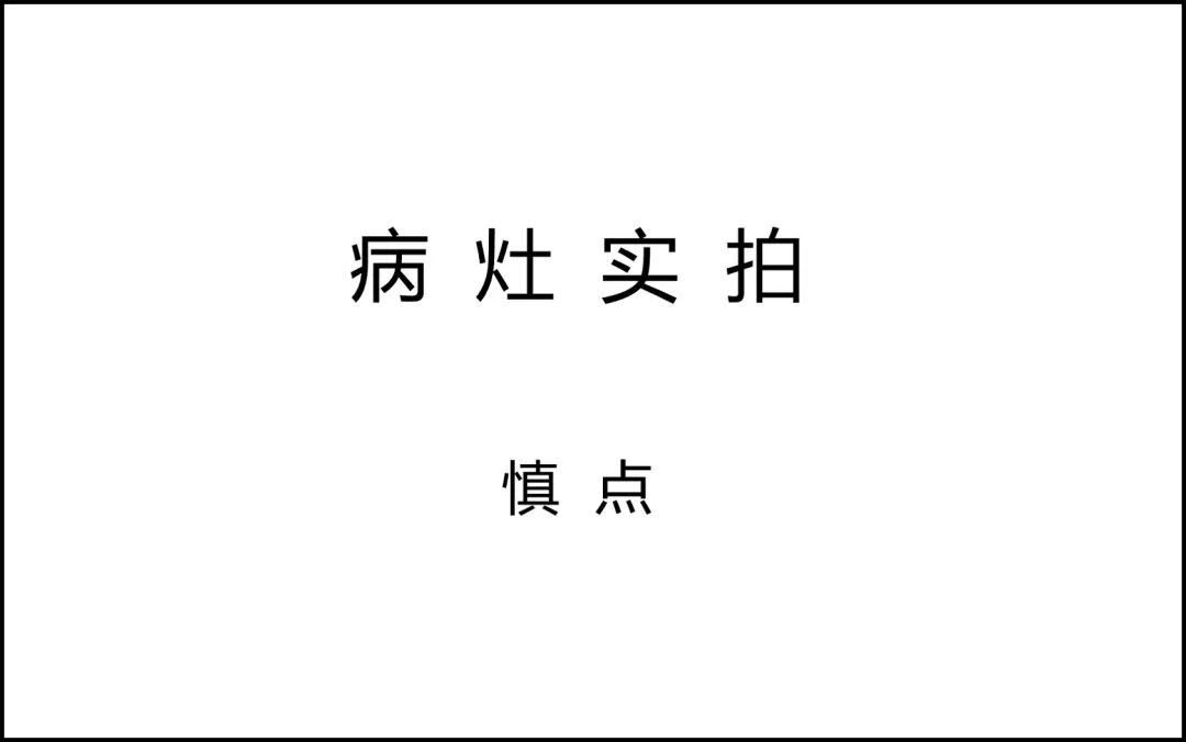 小芳的主治医师和邵教授商议讨论后,初步定下抗非结核分枝杆菌方案