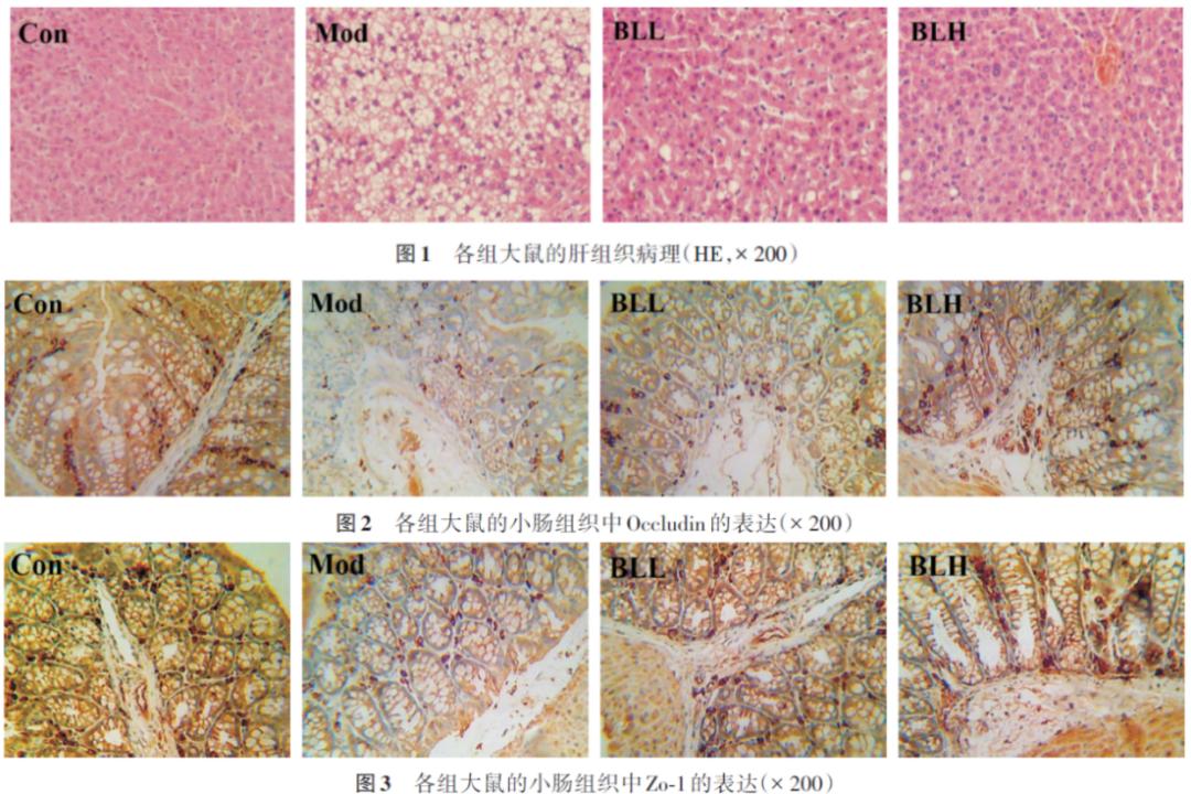 组织和小肠组织病理对比结果发现,地衣芽孢杆菌可显著缓解肝脂肪变性