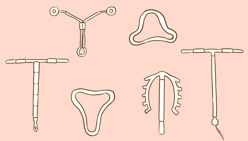 节育环是一种放置在子宫腔内的避孕装置,由于初期使用的装置多是环状