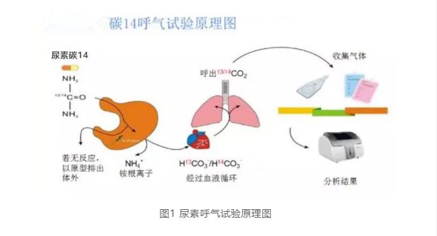 【邮医体检须知(八)】体检中心开展碳14呼气试验专项检测幽门螺杆菌