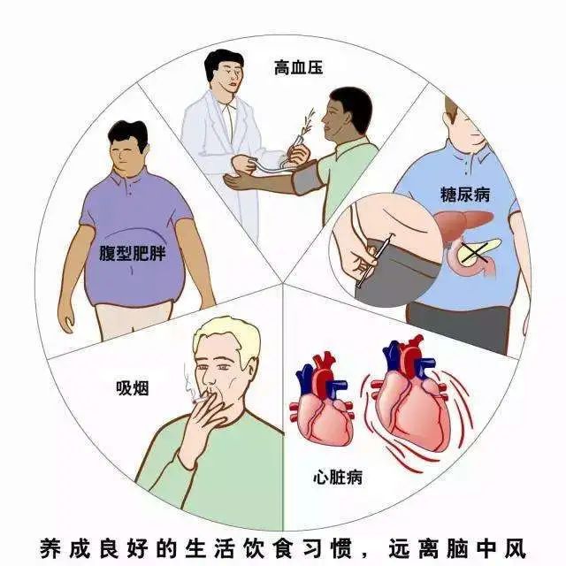 金医健康∣卒中日话卒中(4)缺血性脑卒中二级预防