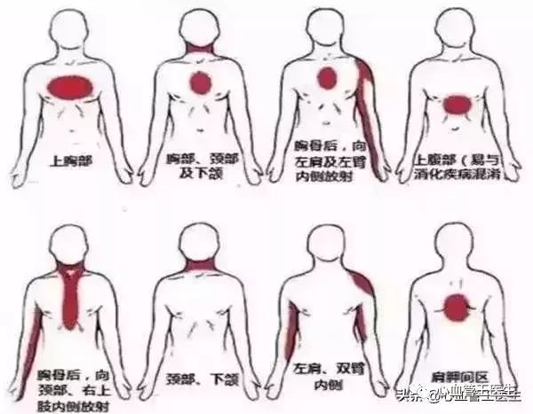 心脏有点不舒服,怎么判断是不是心血管狭窄,是不是心绞痛?